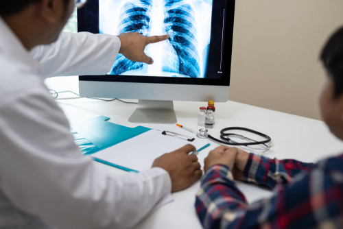 tuberculosis chest X-ray